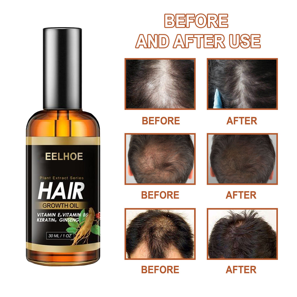 Strong Roots Hair Elixir
