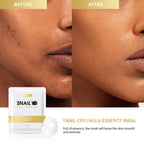 Moisturizing Snail Mask Blackhead Removal