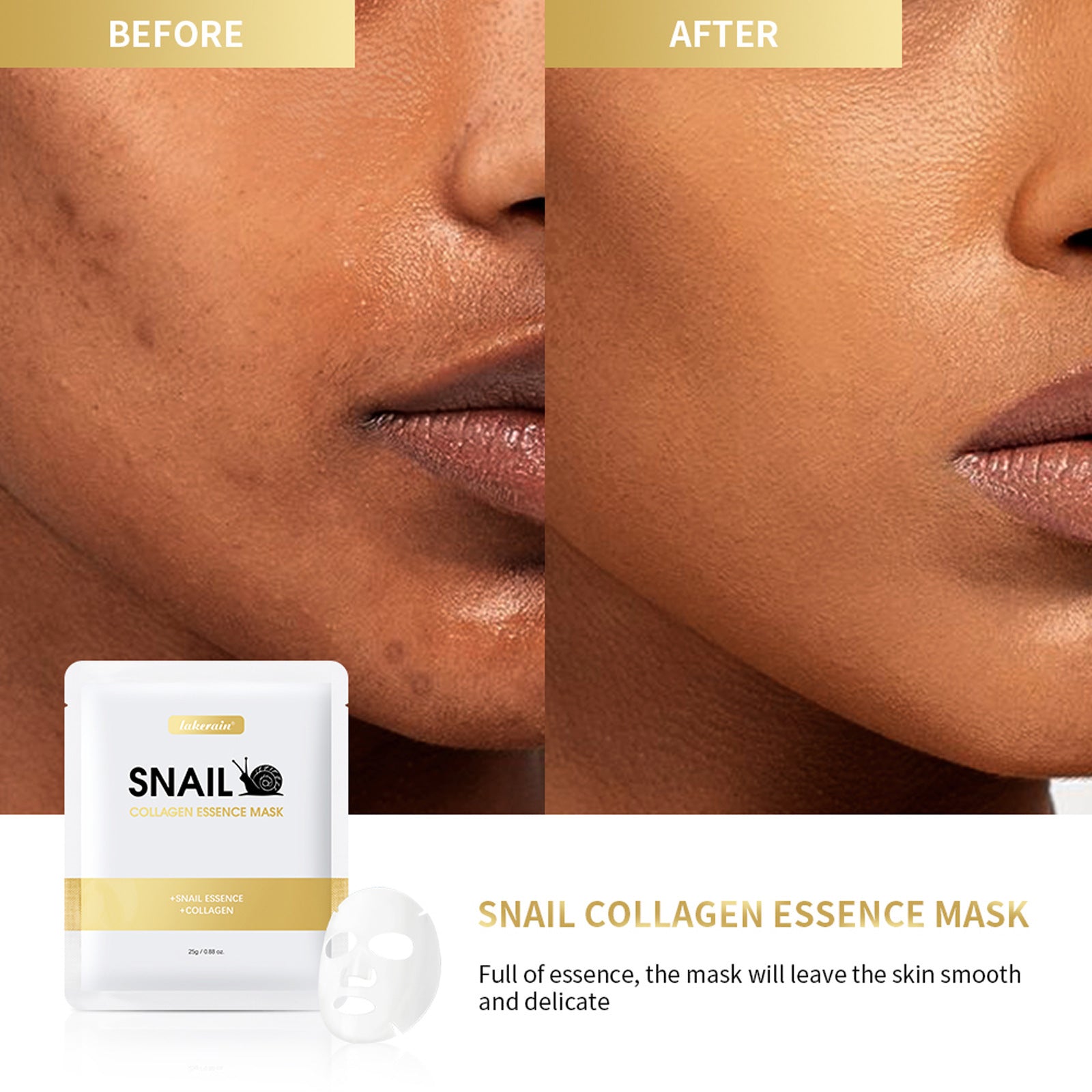 Moisturizing Snail Mask Blackhead Removal