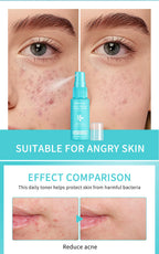 Fresh Facial Spray